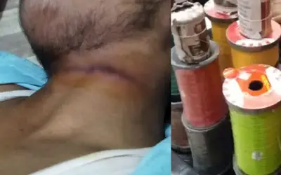 चाइनीज मांझा से गला कटने पर एक शख्स की मौत