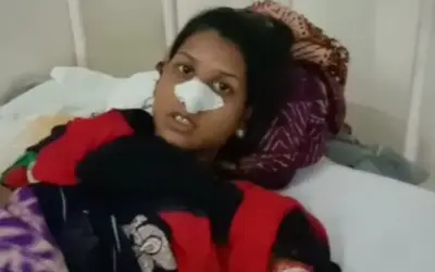 पति ने दांत से काटी पत्नी की नाक