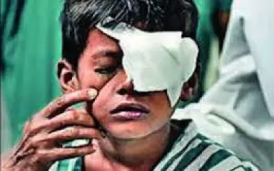 दिवाली की आतिशबाजी में 50 लोगों की आंखें हुई जख्मी
