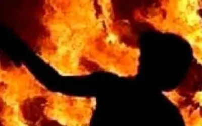 दरोगा ने थाने में दिव्यांग आरोपी को पीटा तो उसने खुद को जला लिया
