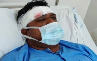 चोर ने फोड़ा पुलिस का सिर