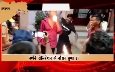 Birthday boy badly burnt by sparkle candle