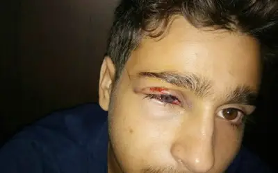 प्रिंसिपल के पीटने से छात्र ने खोयी अपनी दाहिनी आँख की रौशनी